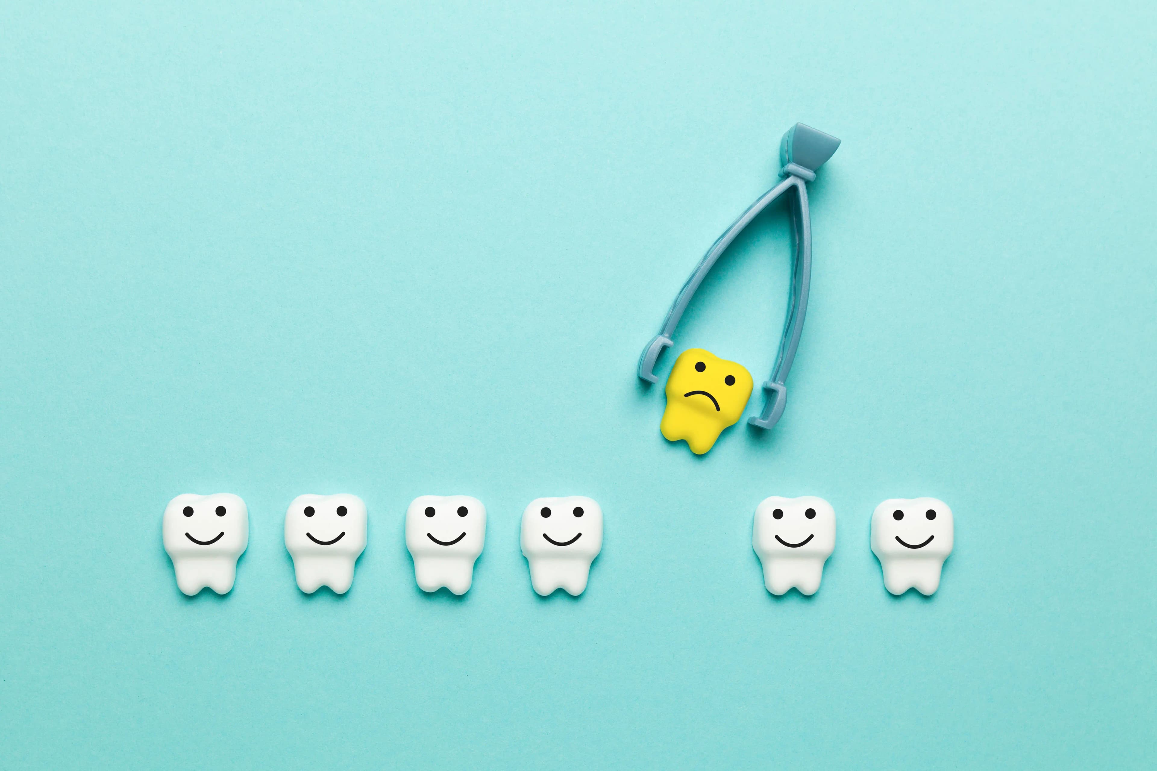 Recovery Guide: After Single Tooth Extraction